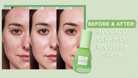 Avocado Ceramide Recovery Serum